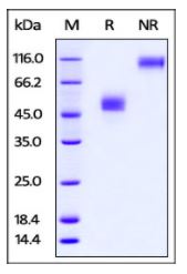 Rabbit TIGIT, Fc Tag on SDS-PAGE under reducing (R) and non-reducing (NR) conditions. The gel was stained overnight with Coomassie Blue. The purity of the protein is greater than 95%.